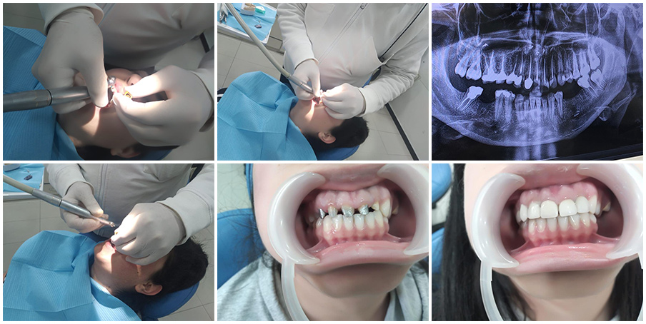 New smile for Inessa Mardoyan New smile for Inessa Mardoyan