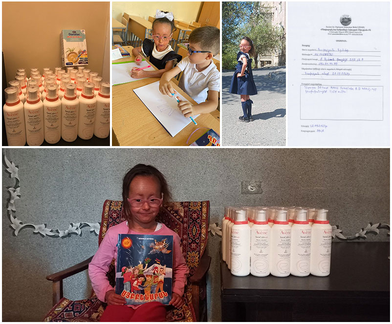 Mari Hakobyan received a 3-month supply of her medicated creams through the SOAR Services to Children in Their Own Homes Sponsorship Fund